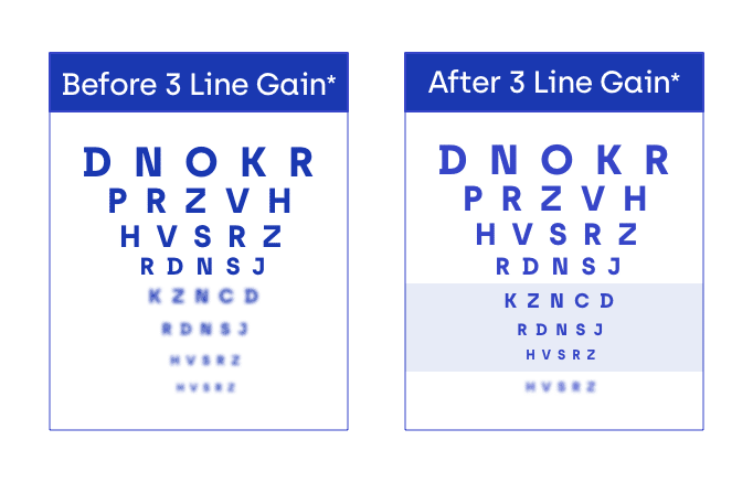 vision eye chart